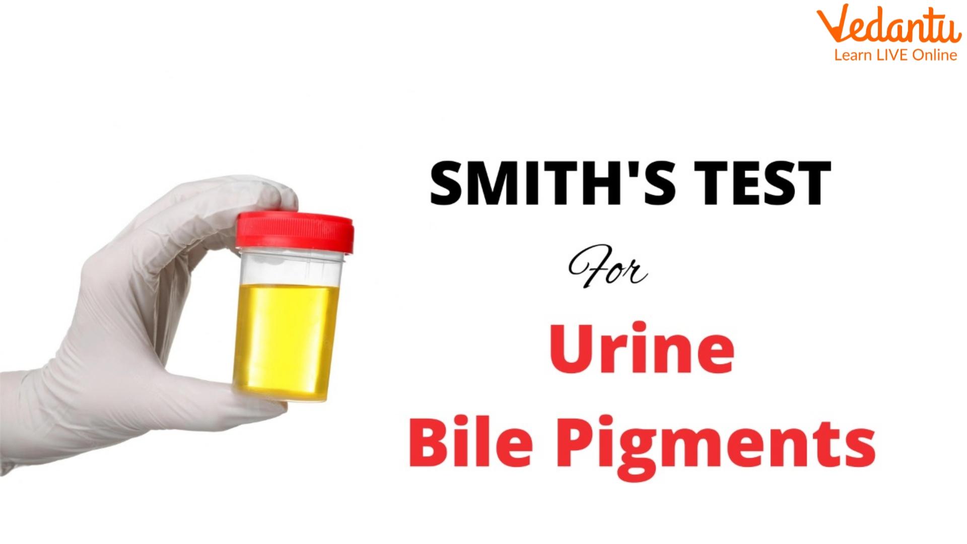 smith's test