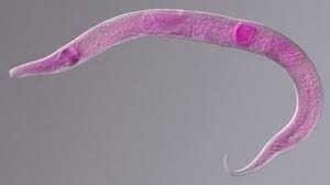 Ascaris (roundworm)