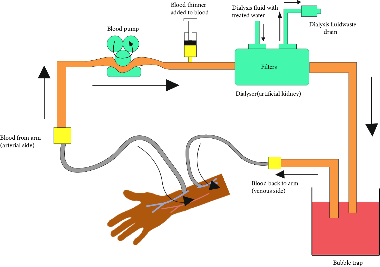 Procedure of Dialysis