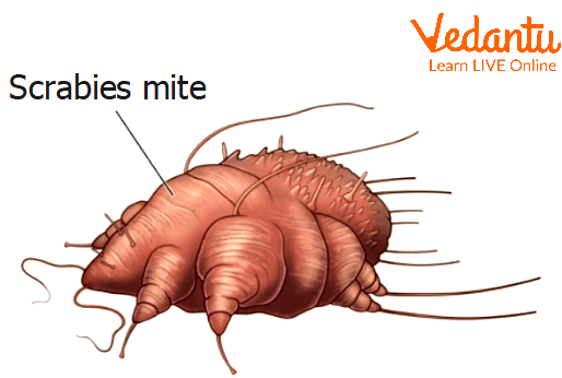 Scabies Mite